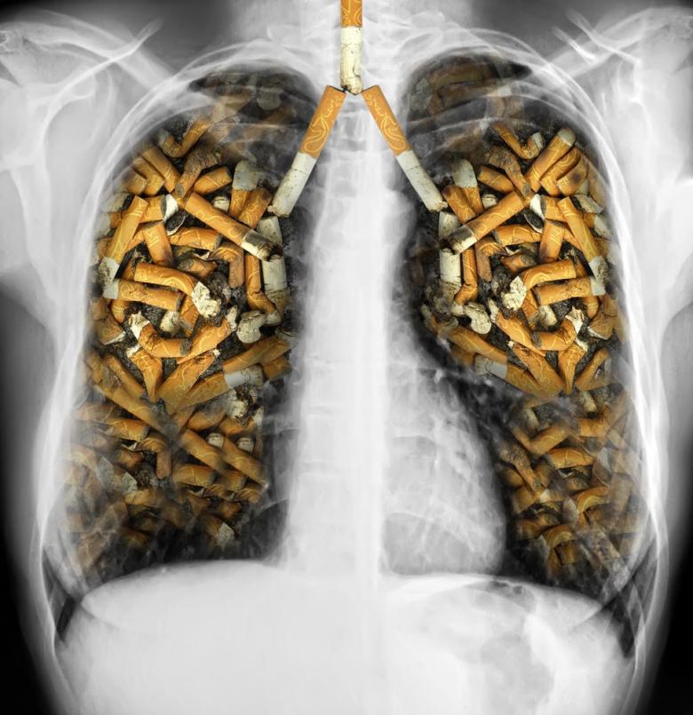 cig lungs